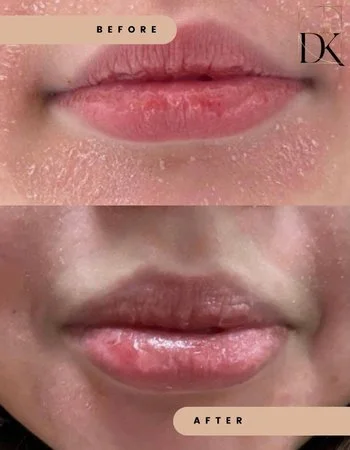 Консультація дерматолога-449