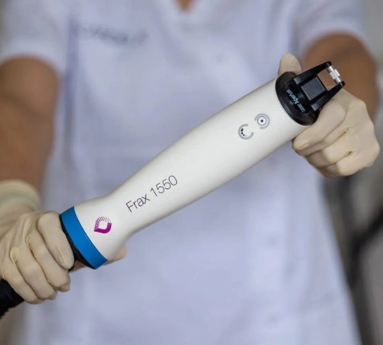 Фракційне омолодження Frax Pro Candela tab-166