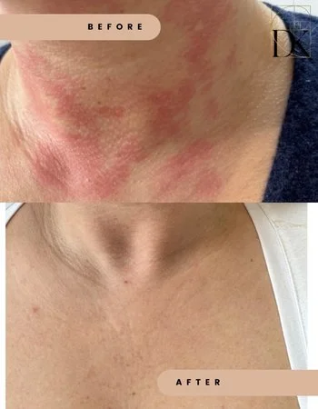 Консультация дерматолога-452