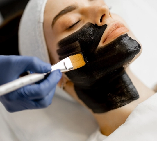 Карбоновый лазерный пилинг Cutera Genesis tab-114