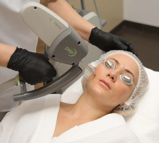 Лазерная шлифовка Cutera Pearl tab-112